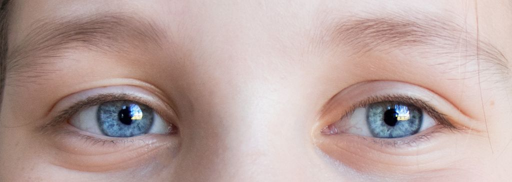 Understanding the Effect of Glaucoma on the Life of Young Patients